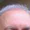 hair line picture
