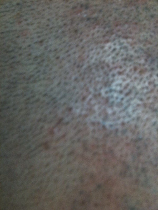 close up